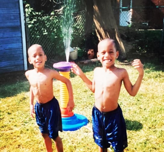 Jordan and Jeremy Allen, founders of All Love No Beef, as kids with alopecia